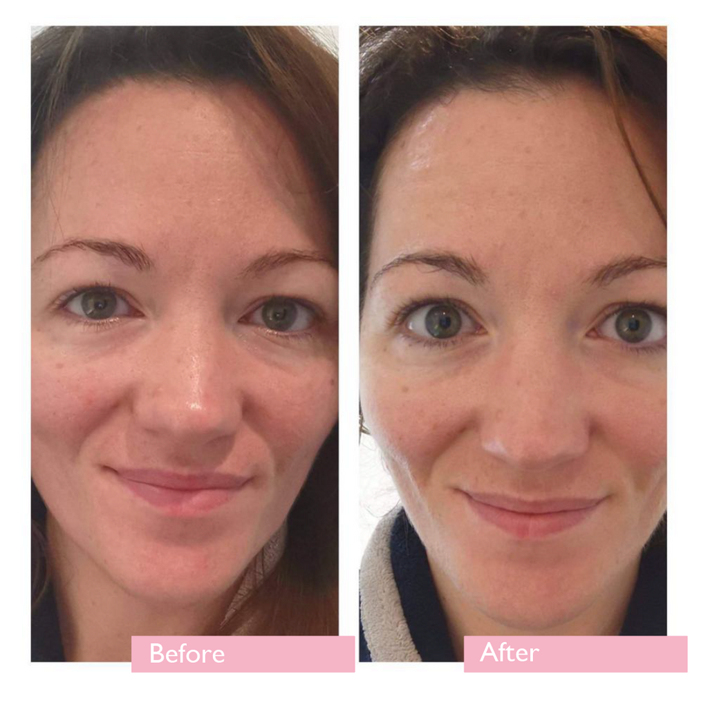 Radiance Eye Gel | for Anti-Aging & Dark Circles Facial Care PurityNaturalBeautyUK