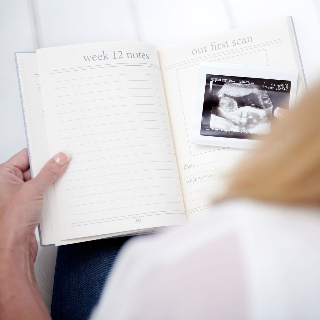 Bloom | My Pregnancy Story | a Memory Book for Your Pregnancy Journey Journal meminio   